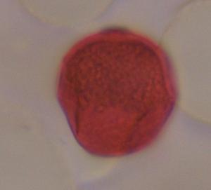 unknown pollen under a microscope, verified by PollyMap