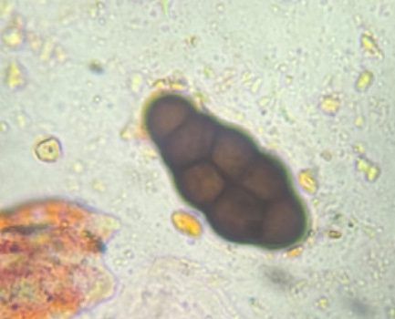 Microscope image of Pithomyces — mold (public specimen library) — verified by PollyMap