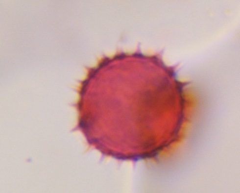 Asteraceae pollen under a microscope, verified by PollyMap