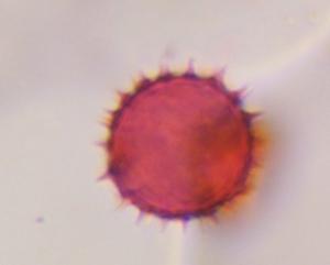 Asteraceae pollen under a microscope, verified by PollyMap