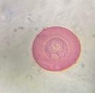 Juniper pollen under a microscope, verified by PollyMap