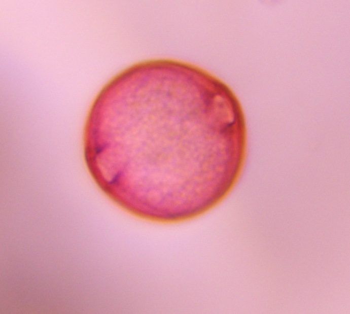 Unknown pollen under a microscope, verified by PollyMap