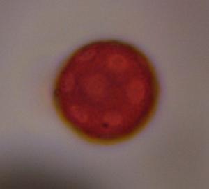 Plantago pollen under a microscope, verified by PollyMap