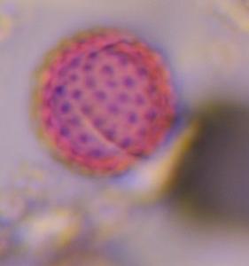 Asteraceae pollen under a microscope, verified by PollyMap