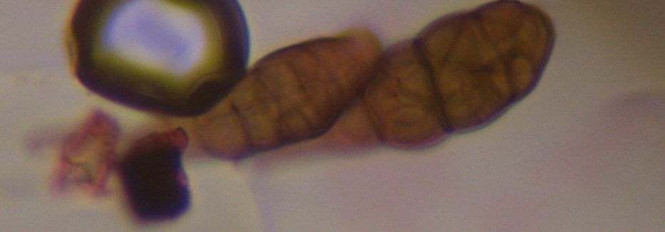 Alternaria mold spore under a microscope, verified by PollyMap