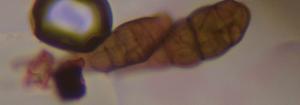 Alternaria mold spore under a microscope, verified by PollyMap