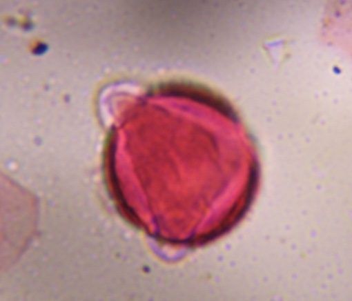 Another microscope image of Artemisia, verified by PollyMap