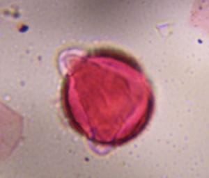 Artemisia pollen under a microscope, verified by PollyMap