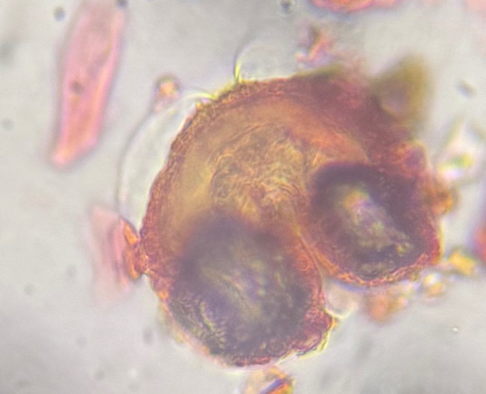 Another microscope image of Pine, verified by PollyMap