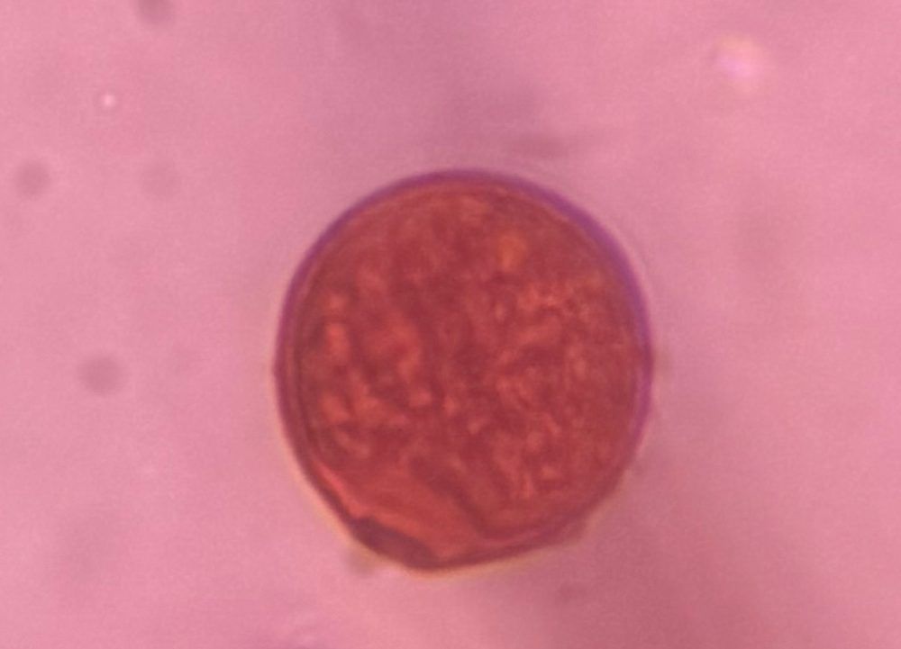 Grass pollen under a microscope, verified by PollyMap