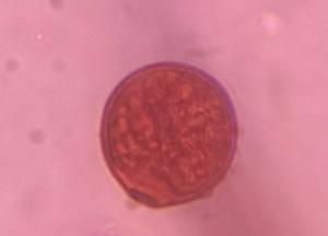 Grass pollen under a microscope, verified by PollyMap