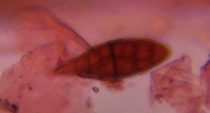 Alternaria mold spore under a microscope, verified by PollyMap