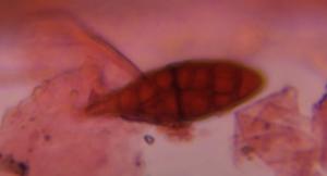 Alternaria mold spore under a microscope, verified by PollyMap