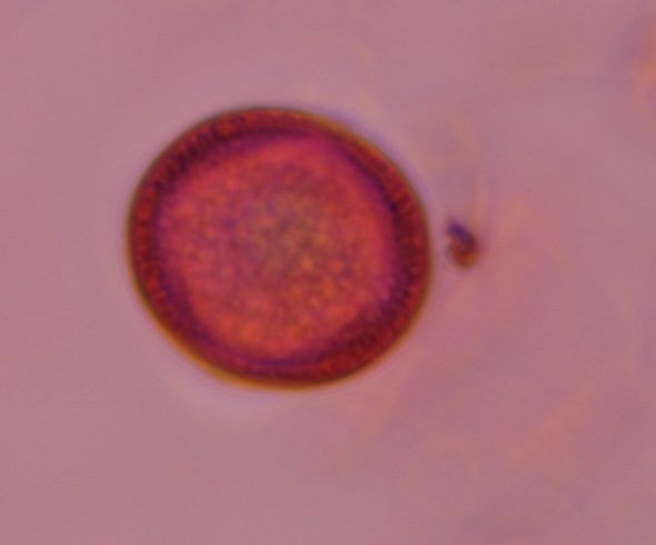 Another microscope image of Artemisia, verified by PollyMap