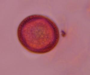 Artemisia pollen under a microscope, verified by PollyMap