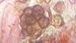 Epicoccum mold spore under a microscope, verified by PollyMap