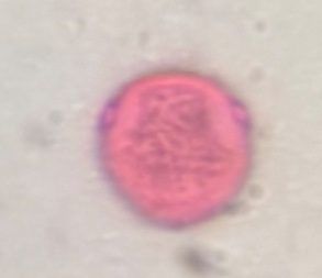 Celtis pollen under a microscope, verified by PollyMap