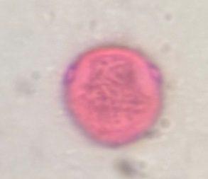 Celtis pollen under a microscope, verified by PollyMap