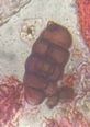 Ulocladium mold spore under a microscope, verified by PollyMap