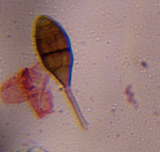 Alternaria mold spore under a microscope, verified by PollyMap