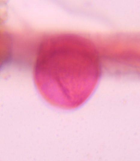 Unknown pollen under a microscope, verified by PollyMap