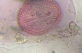 Olive pollen under a microscope, verified by PollyMap
