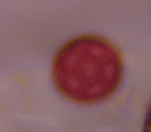 Plantago pollen under a microscope, verified by PollyMap