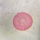 Juniper pollen under a microscope, verified by PollyMap