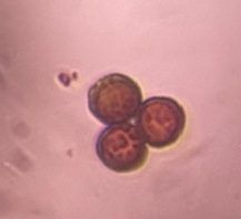Epicoccum mold spore under a microscope, verified by PollyMap