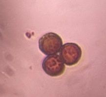 Epicoccum mold spore under a microscope, verified by PollyMap