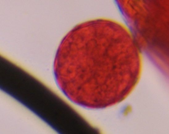 Chenopod pollen under a microscope, verified by PollyMap