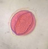 Oak pollen under a microscope, verified by PollyMap