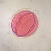 Oak pollen under a microscope, verified by PollyMap