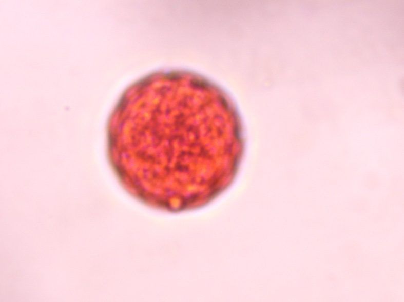 Another microscope image of Chenopod, verified by PollyMap