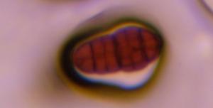 Stemphylium mold spore under a microscope, verified by PollyMap