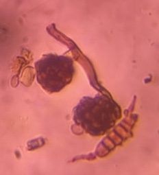 Another microscope image of Alternaria, verified by PollyMap