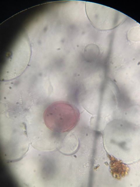 Unidentified pollen under a microscope, verified by PollyMap