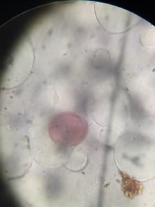 Unidentified pollen under a microscope, verified by PollyMap