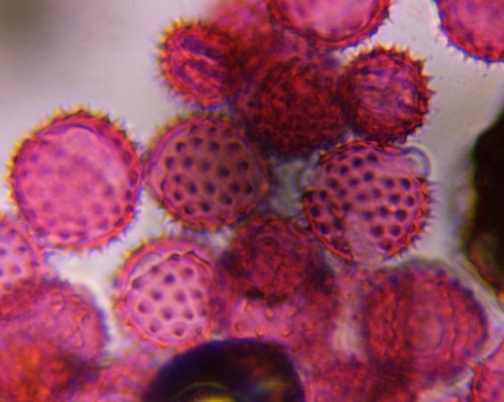 Asteraceae (low spine) pollen under a microscope, verified by PollyMap