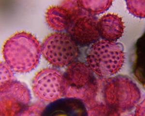 Asteraceae (low spine) pollen under a microscope, verified by PollyMap