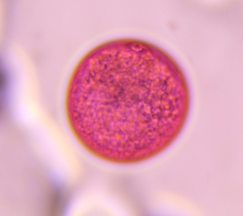 Poaceae pollen under a microscope, verified by PollyMap