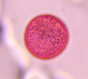Poaceae pollen under a microscope, verified by PollyMap