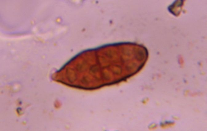 Alternaria mold spore under a microscope, verified by PollyMap