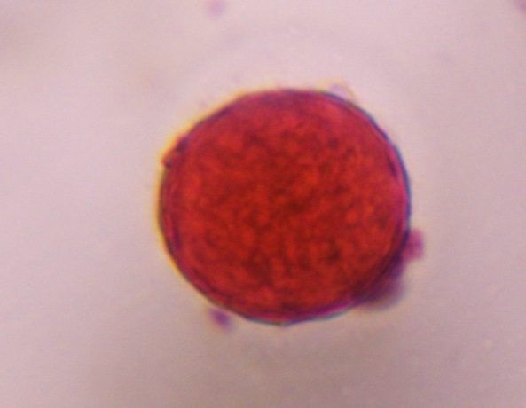 Chenopod pollen under a microscope, verified by PollyMap