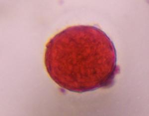 Chenopod pollen under a microscope, verified by PollyMap