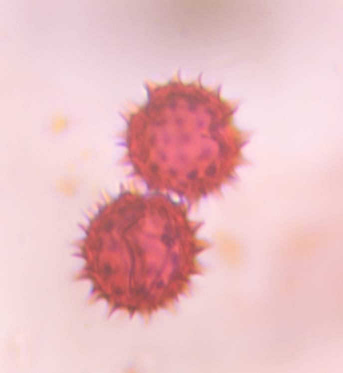 Microscope image of Asteraceae (high spine) — pollen (reference) — verified by PollyMap