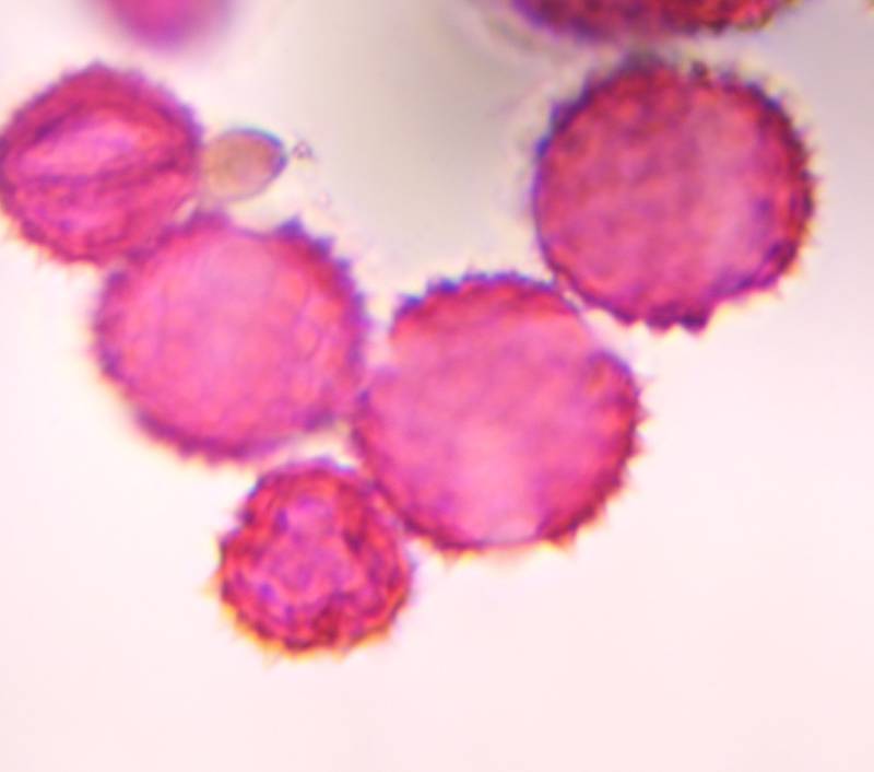 Microscope image of Astereceae (low spine) — pollen (reference) — verified by PollyMap