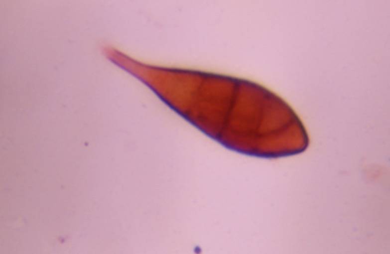 Microscope image of Alternaria — mold (gallery) — verified by PollyMap
