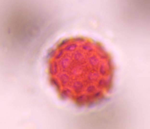 Microscope image of Chenopod — pollen (gallery) — verified by PollyMap
