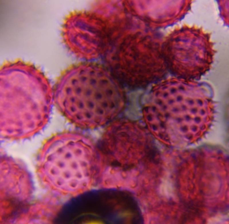 Microscope image of Asteraceae (low spine) — pollen (gallery) — verified by PollyMap